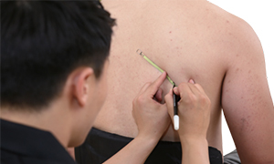 등 뒤 어깨뼈 하단부분에 펜으로 표시를 하고있는 검사자