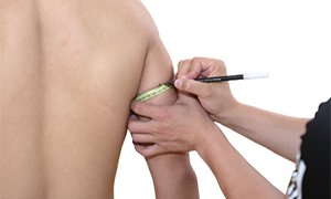 팔 뒤쪽에 줄자로 두르고 펜으로 표시를 하고있는 검사자